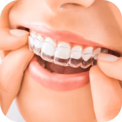 Sonrisa con alineadores Moons