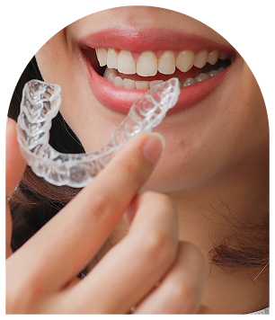 Ortodoncia Invisible