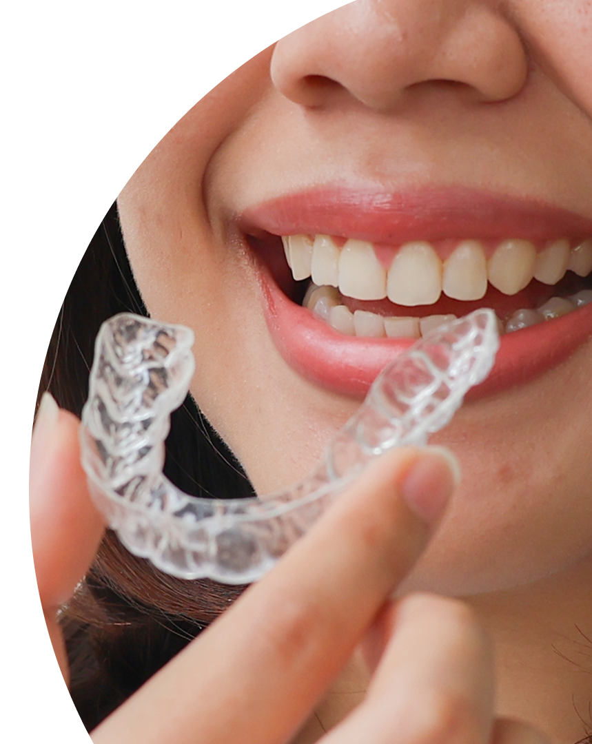 Ortodoncia Invisible