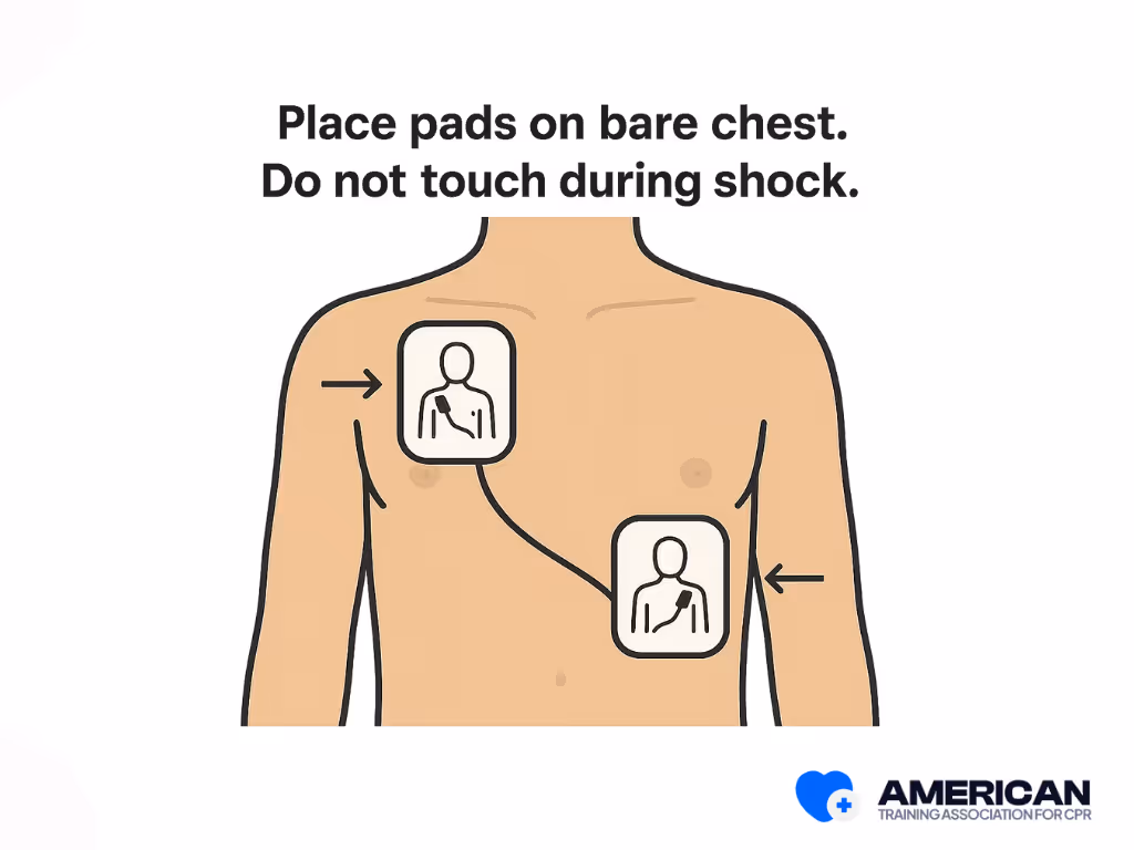 defibrillation guide for ventricular tachycardia