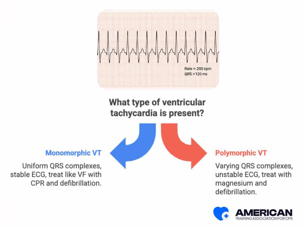 the Difference Between Monomorphic and Polymorphic VT