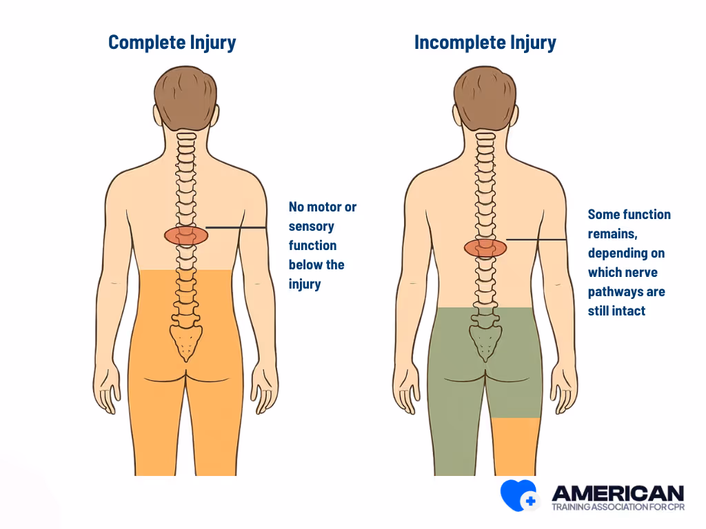 complete injury vs incomplete injury