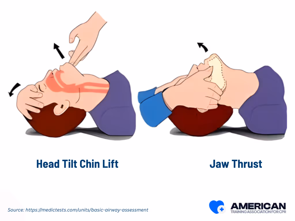 head tilt chin lift vs jaw thrusts