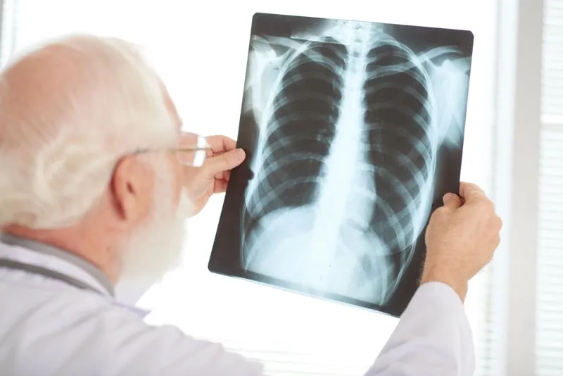 5 Lung Cleansing Foods After Quitting Smoking