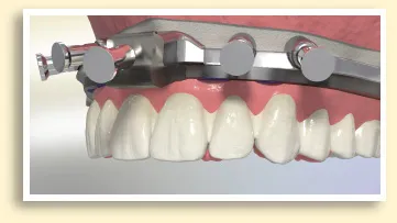 Prod Essentials eXact XD