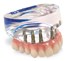 Upper Showcase Model