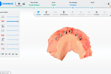 Dental scan of upper jaw with six implanted abutments shown in a dental software interface.