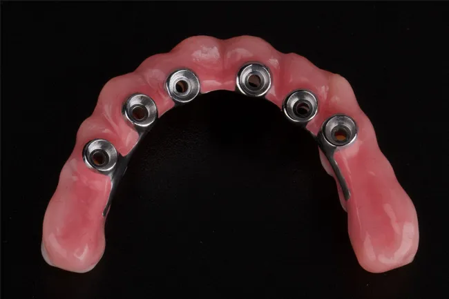 Pink dental prosthetic with six metal implant attachments, shown against black background.