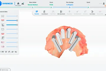 3D dental scan showing a partial upper jaw with six dental implant models in the design software.