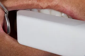 Close-up of a dental tool and a white rectangular object near a person's teeth and mouth.