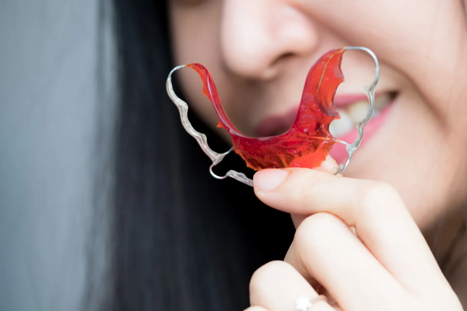 Orthodontic Retainers in Alpharetta, GA | Stable Orthodontics