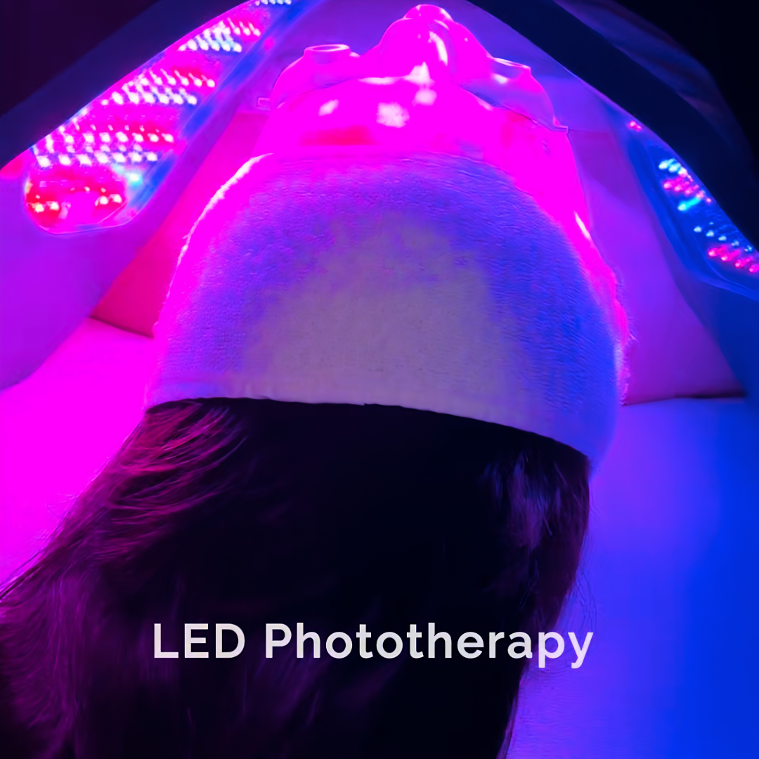 What is LED Phototherapy? LED Light Therapy uses specific wavelengths of light energy to support the skin’s natural repair and rejuvenation processes. This non-invasive treatment works by delivering light energy to the tissue, where it is absorbed by the cells to help enhance cellular function and promote healthier-looking skin. Our LED Phototherapy features targeted
multi-wavelength technology that combines red,
near-infrared, and blue light energy to support your skin’s unique needs. 🔴 Red & Near-Infrared Light
• Helps reduce the appearance of fine lines and wrinkles
• Supports collagen production
• Promotes healthier, more radiant-looking skin
• Helps calm and rejuvenate the complexion 🔵 Blue Light
• Helps target acne-causing bacteria
• Supports clearer-looking skin
• Helps reduce the appearance of blemishes and congestion ✨ Anti-Aging Light Mode
• Combines therapeutic wavelengths to support skin rejuvenation
• Improves the appearance of skin texture and tone
• Encourages a more youthful, luminous glow Relax, unwind, and let the light do the work—naturally. Available as a standalone Skin Enhancement Treatment or as an Add-on to any facial for an extra boost of skin-loving benefits. 💖 #lighttherapy #redlight #antiaging #wellness #acnetreatment