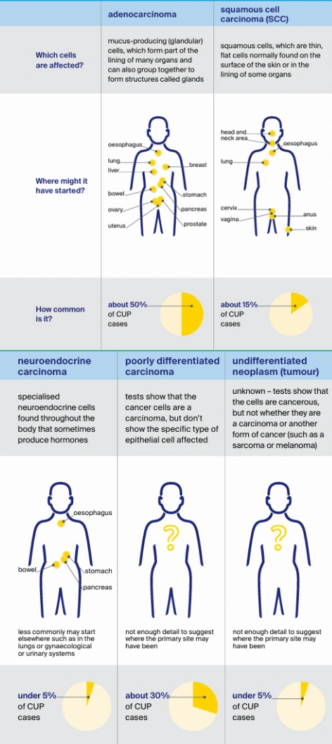 Table describing the different types of cancer of unknown primary, with a description of cells that are affected, where the cancer might have started for each type, and how common each type is. 