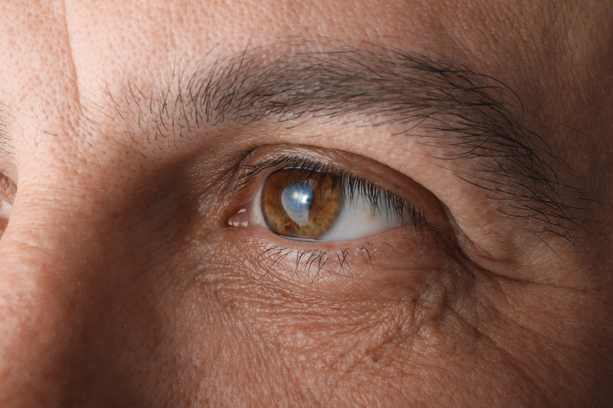 Is the PanOptix Pro Lens Right for You? Benefits and Considerations