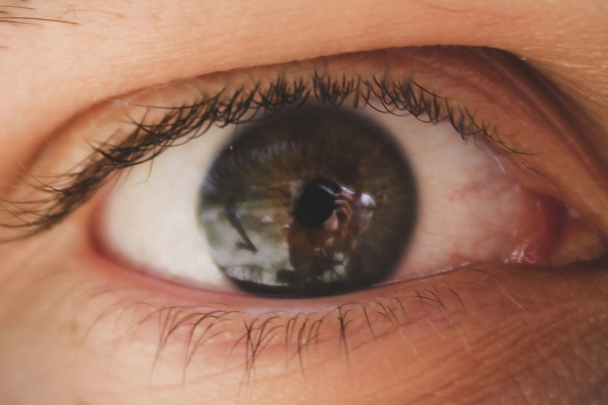 Can Eye Floaters Be a Sign of Something Serious?