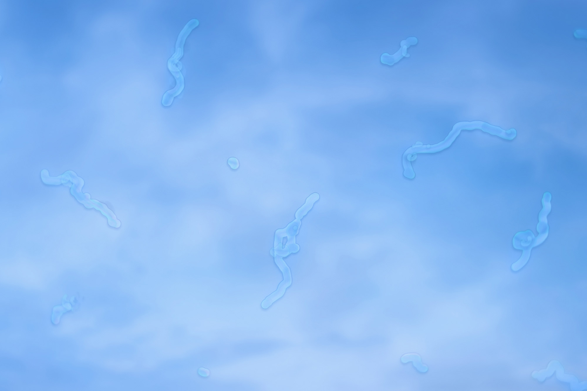 Understanding Floaters: When Should You Worry?