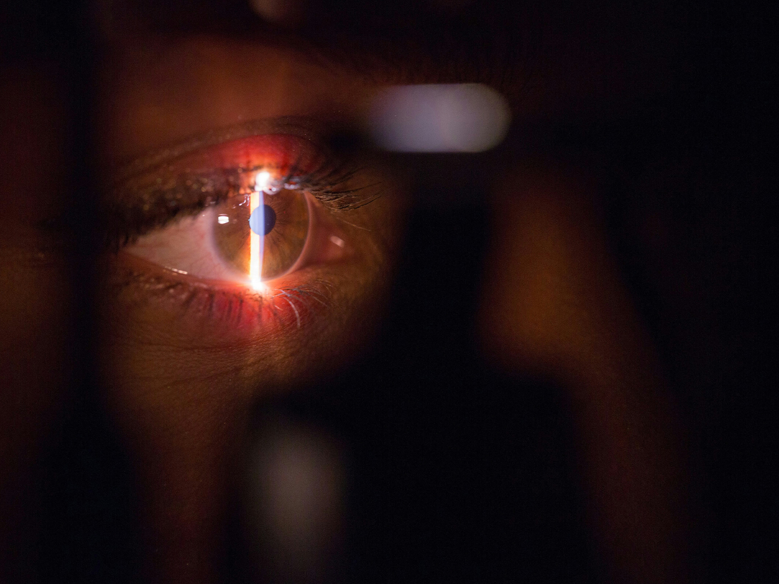 PRK vs. LASIK in 2026: A Boca Raton Ophthalmologist's Guide to Choosing the Right Laser Vision Correction