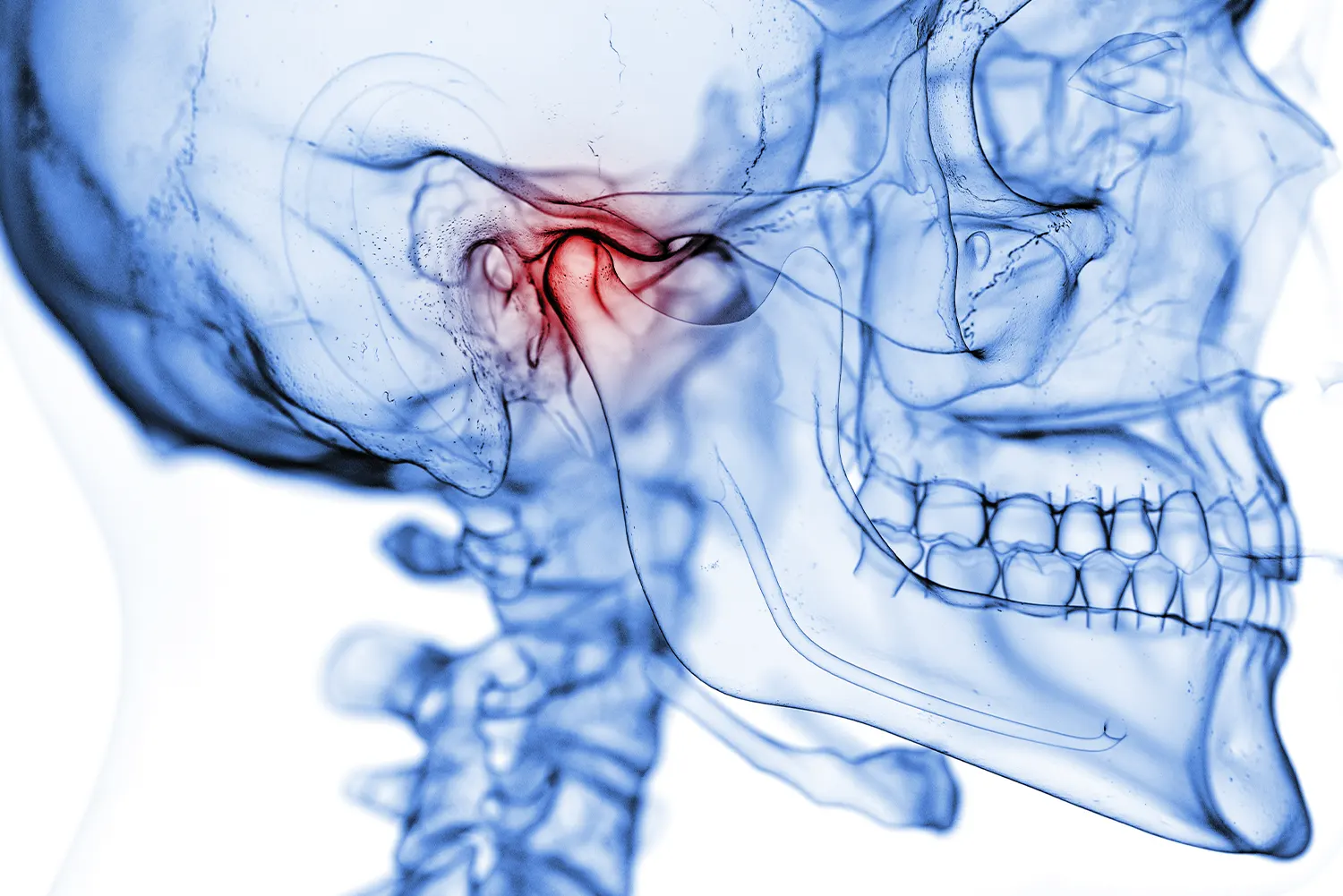 TMJ/TMD Treatment: Relieve Jaw Pain and Restore Function