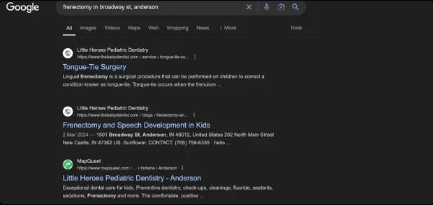 frenectomy keyword search results