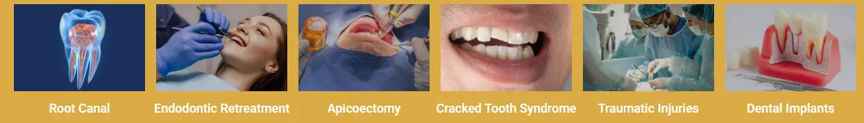endodontic procedures