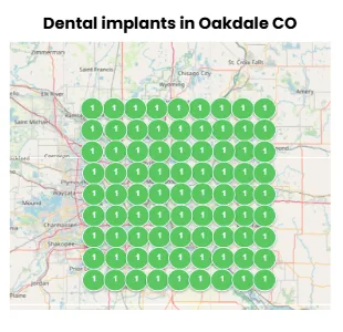 grid data for dental implants in Oakdale CO
