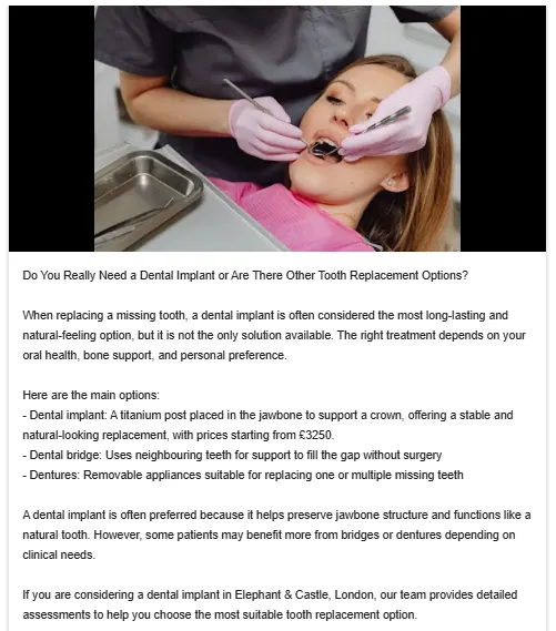 GBP post on dental implant