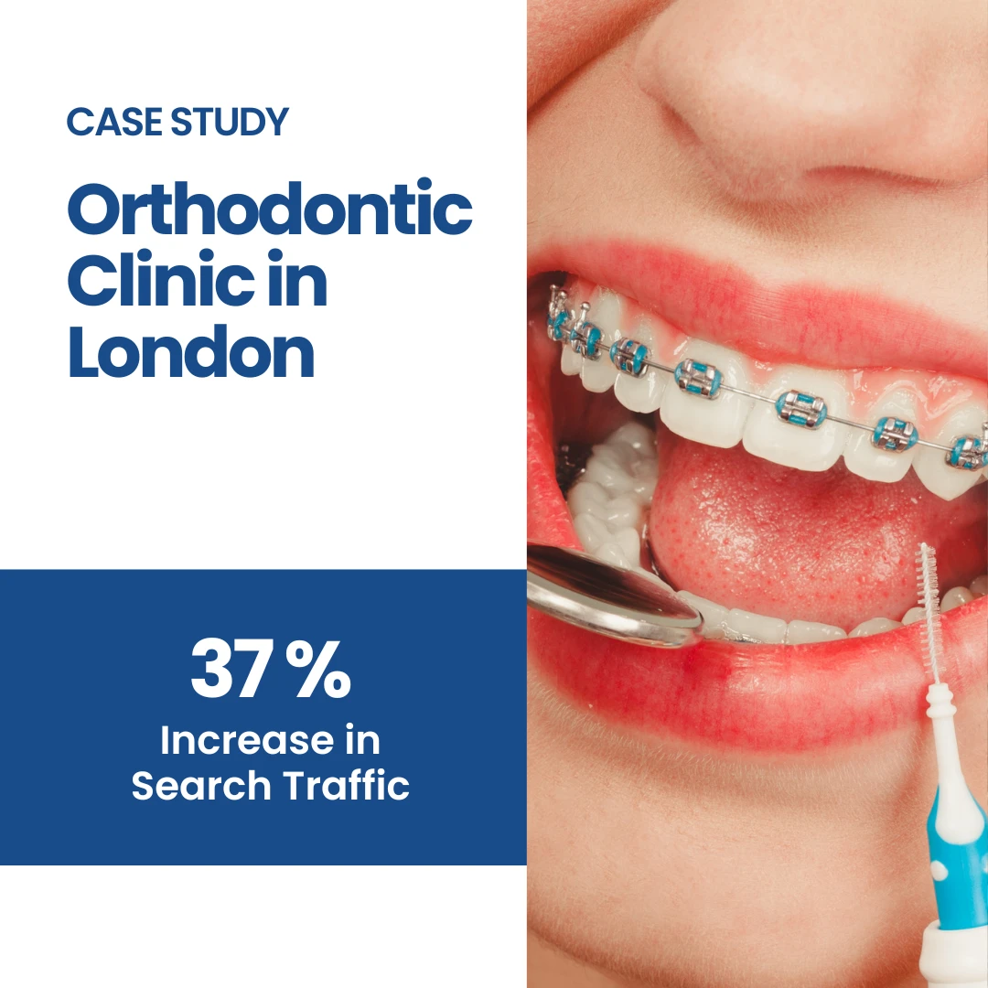 Orthondontic clinic in London