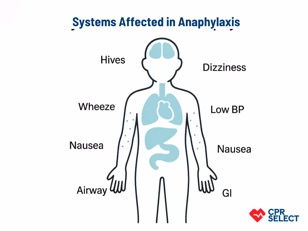 systems affected in anaphylaxis