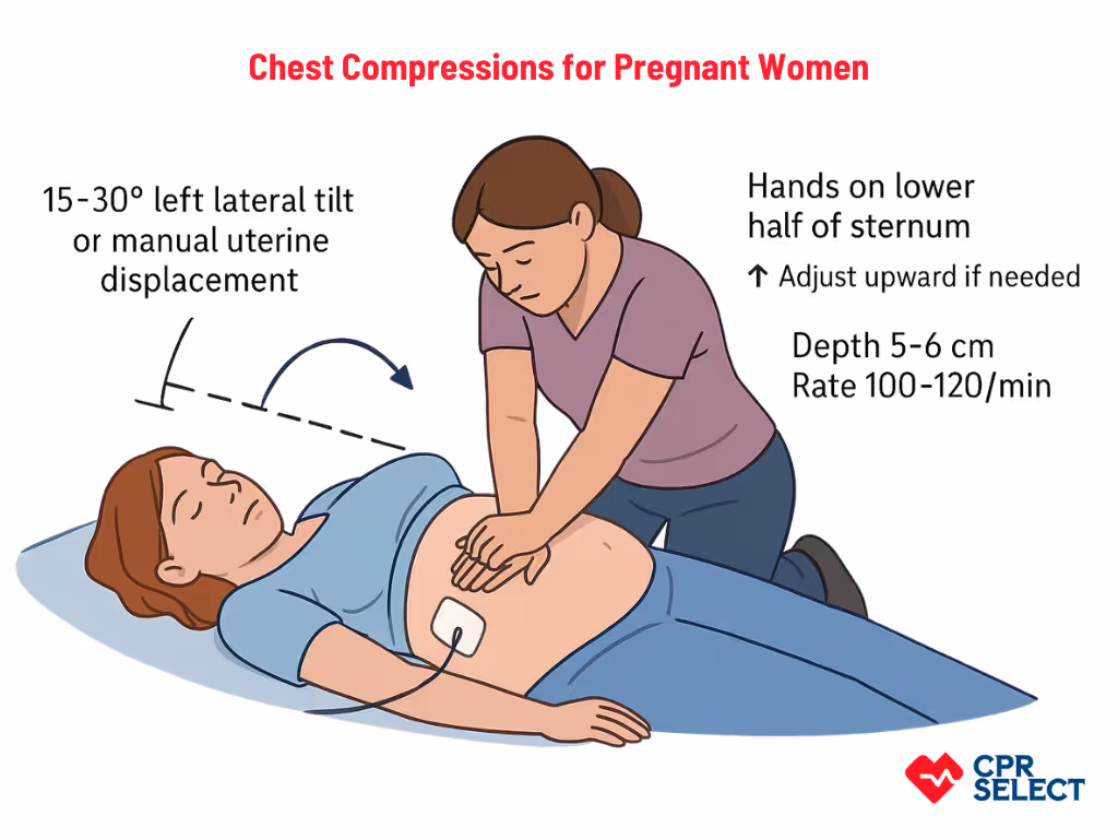 Adjustments to Chest Compressions for Pregnant Patients
