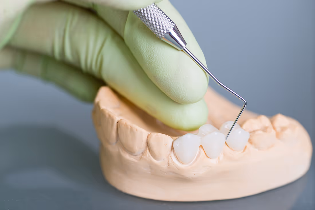 tooth and mirror tool