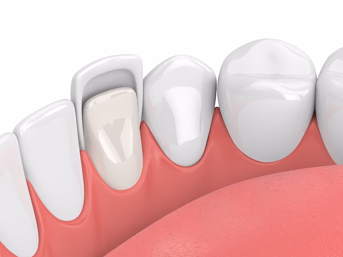 tooth and mirror tool