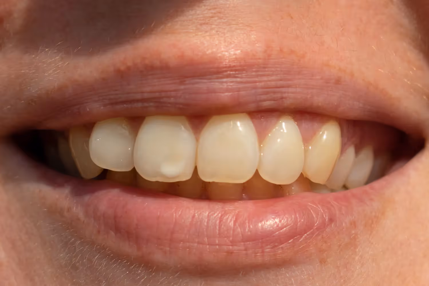 tooth and mirror tool