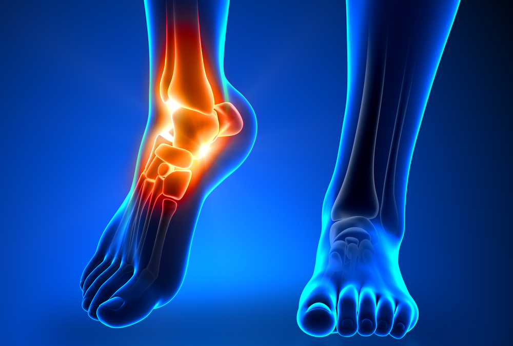 Don't Let Injuries be the End of Your Fitness Journey