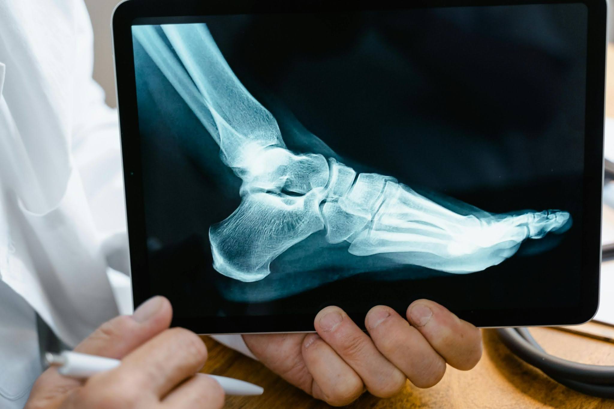 Person Holding Black Tablet Computer displaying an xray