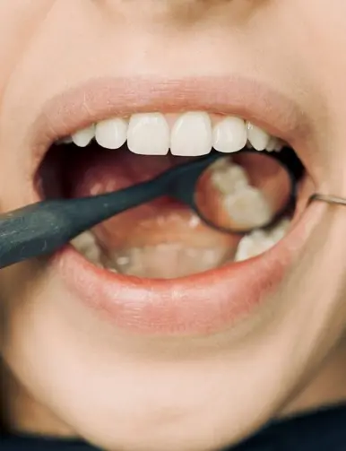 Pediatric dentist reviewing X-ray of baby tooth needing pulpectomy in Pflugerville TX