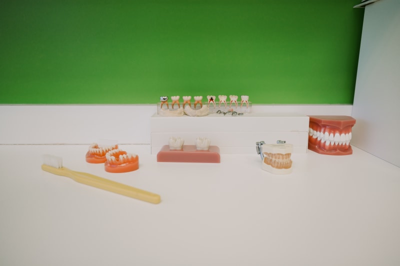 Dental crown models and restorative materials displayed on a green surface showing different restoration options