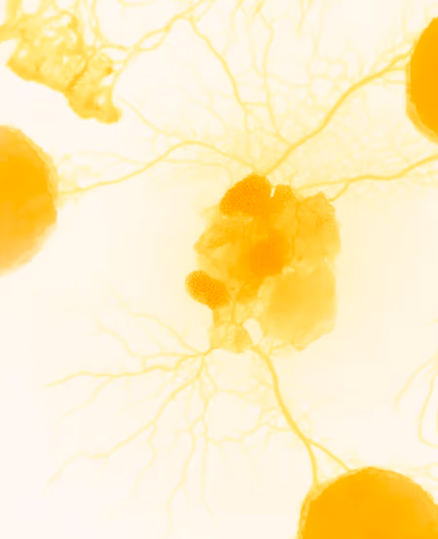 Cells connected by branching lines, with three large circular structures around them, under a microscope.