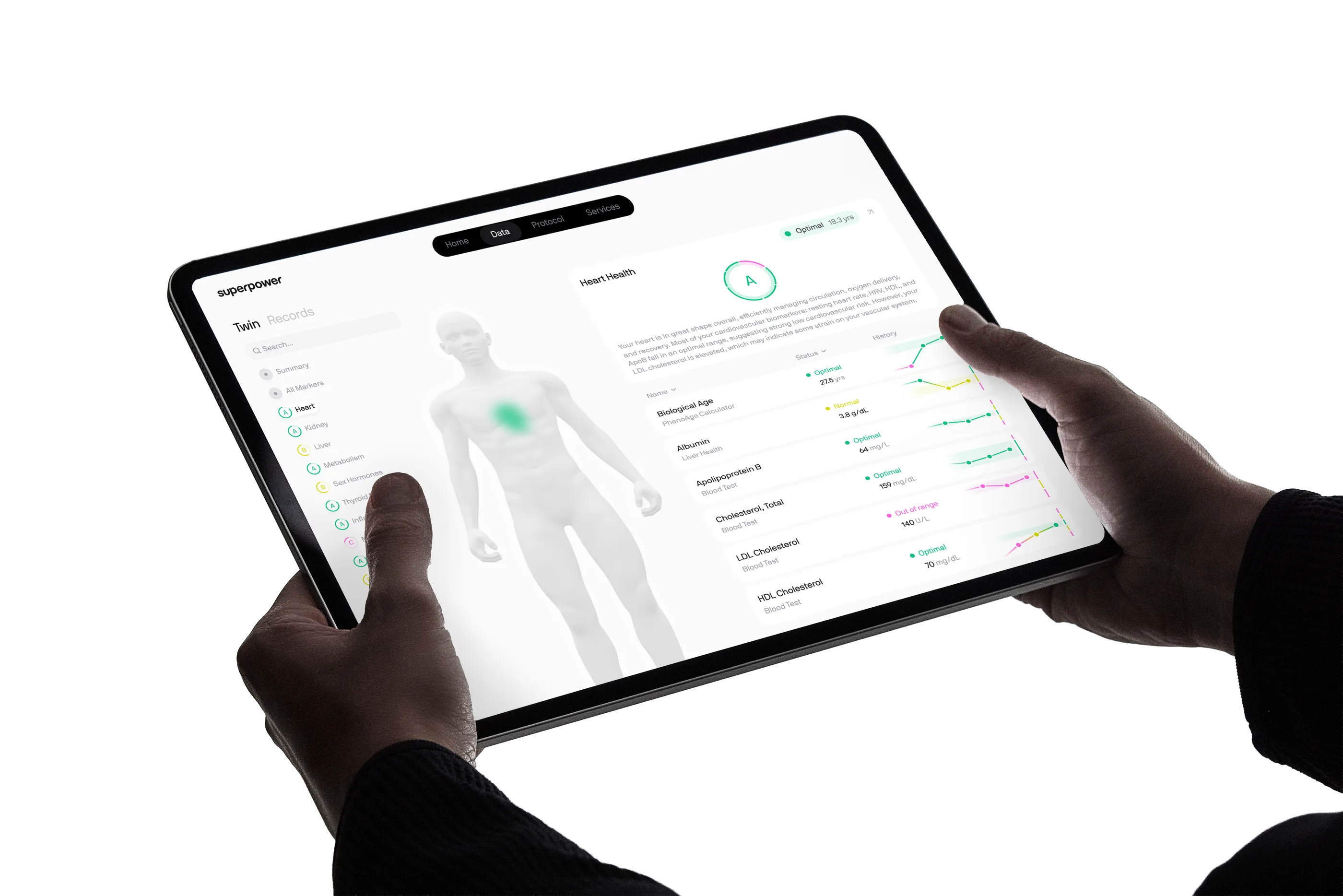 Superpower dashboard on a tablet