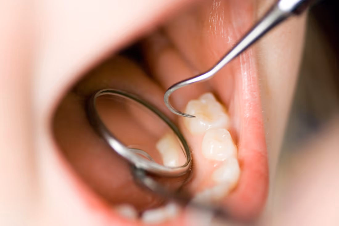 tooth and mirror tool