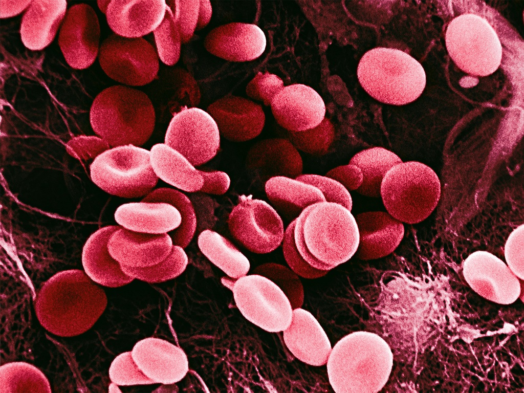 synthetic blood alamy Small