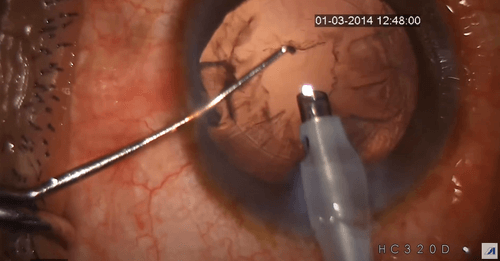 Brilliant advent image