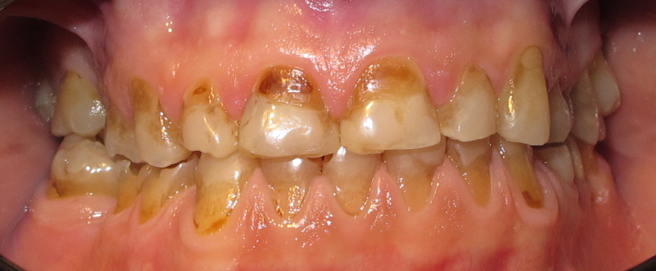 Before
