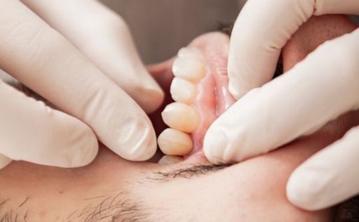 ¿Qué es la necrosis pulpar y por qué debemos prestarle atención?