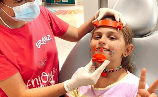 Qué es la Clase III Dental y por qué es importante tratarla a una edad temprana