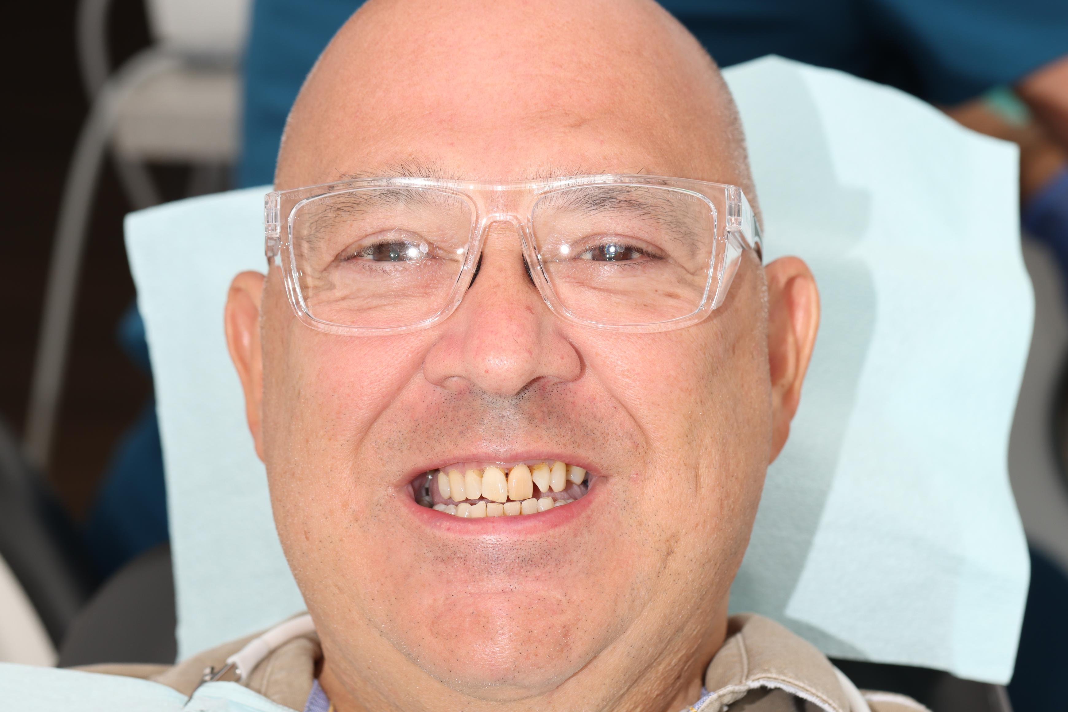 A Paz before treatment