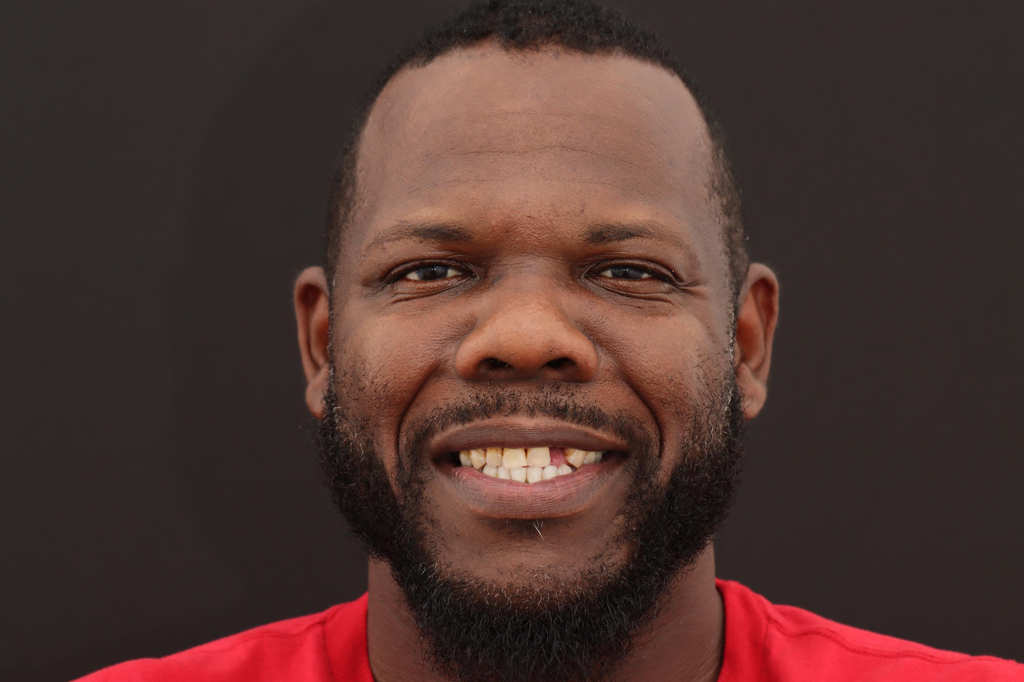 M Bryant before treatment