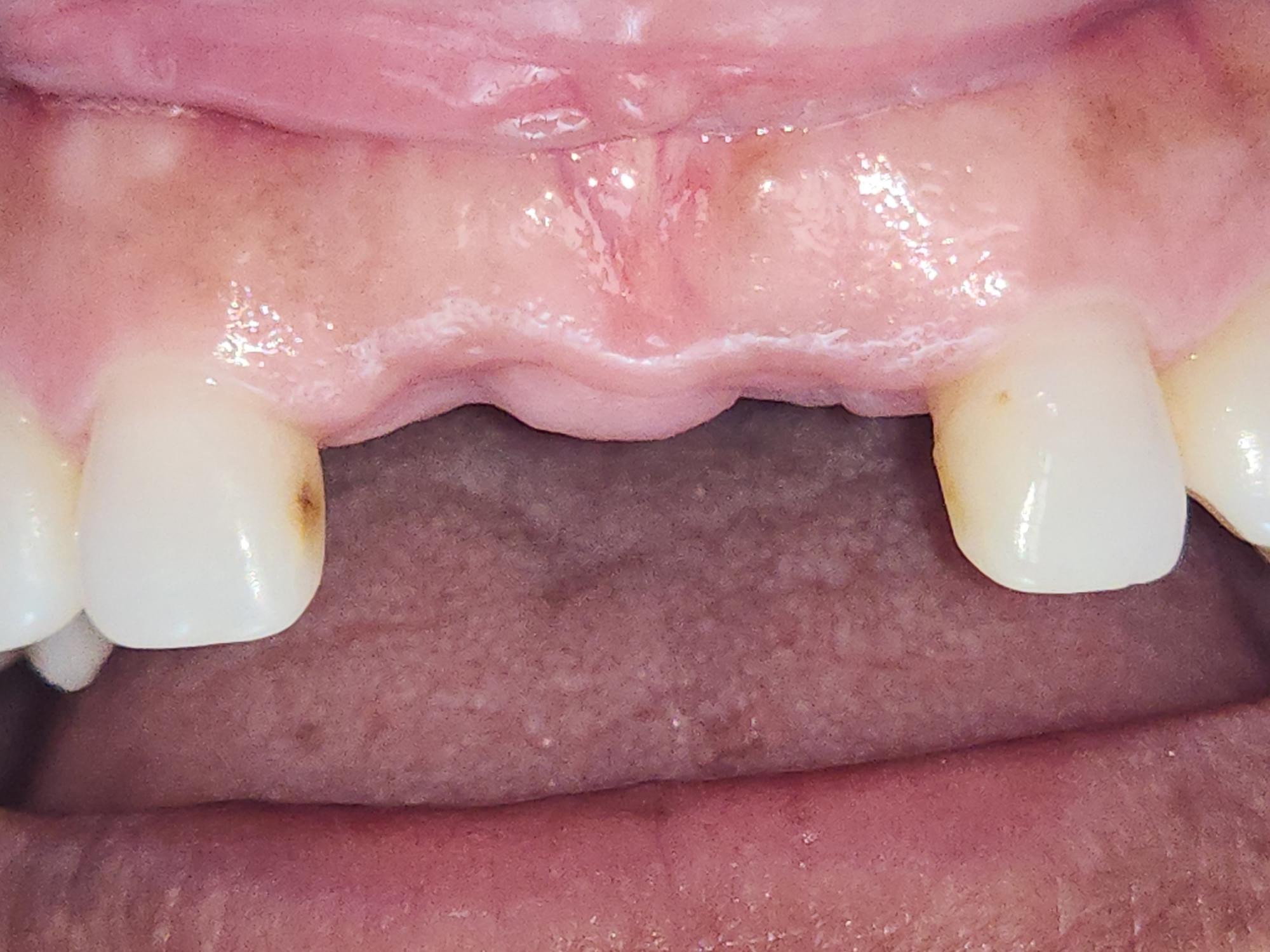 R Lab before treatment
