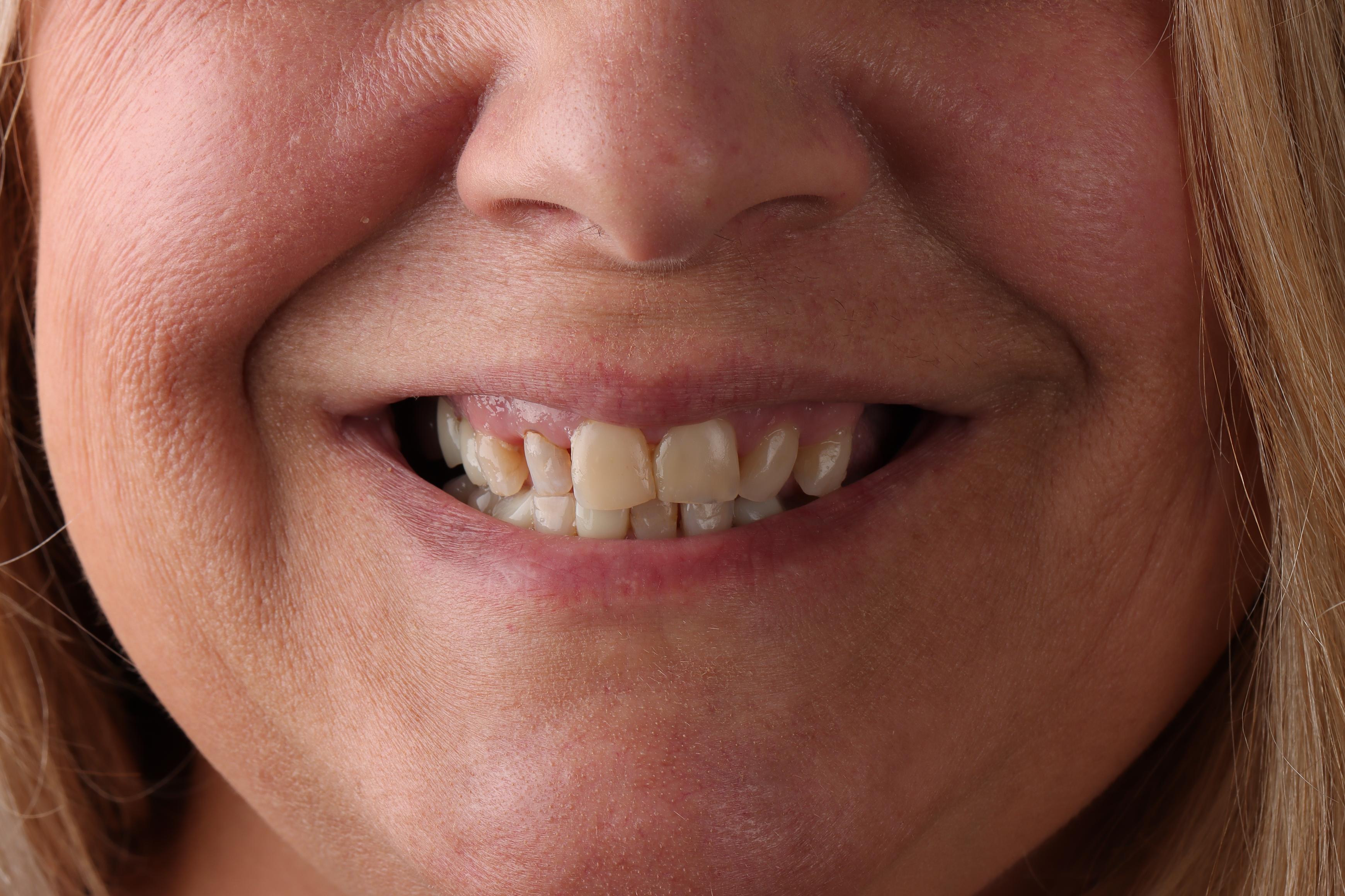 S Dugas before treatment