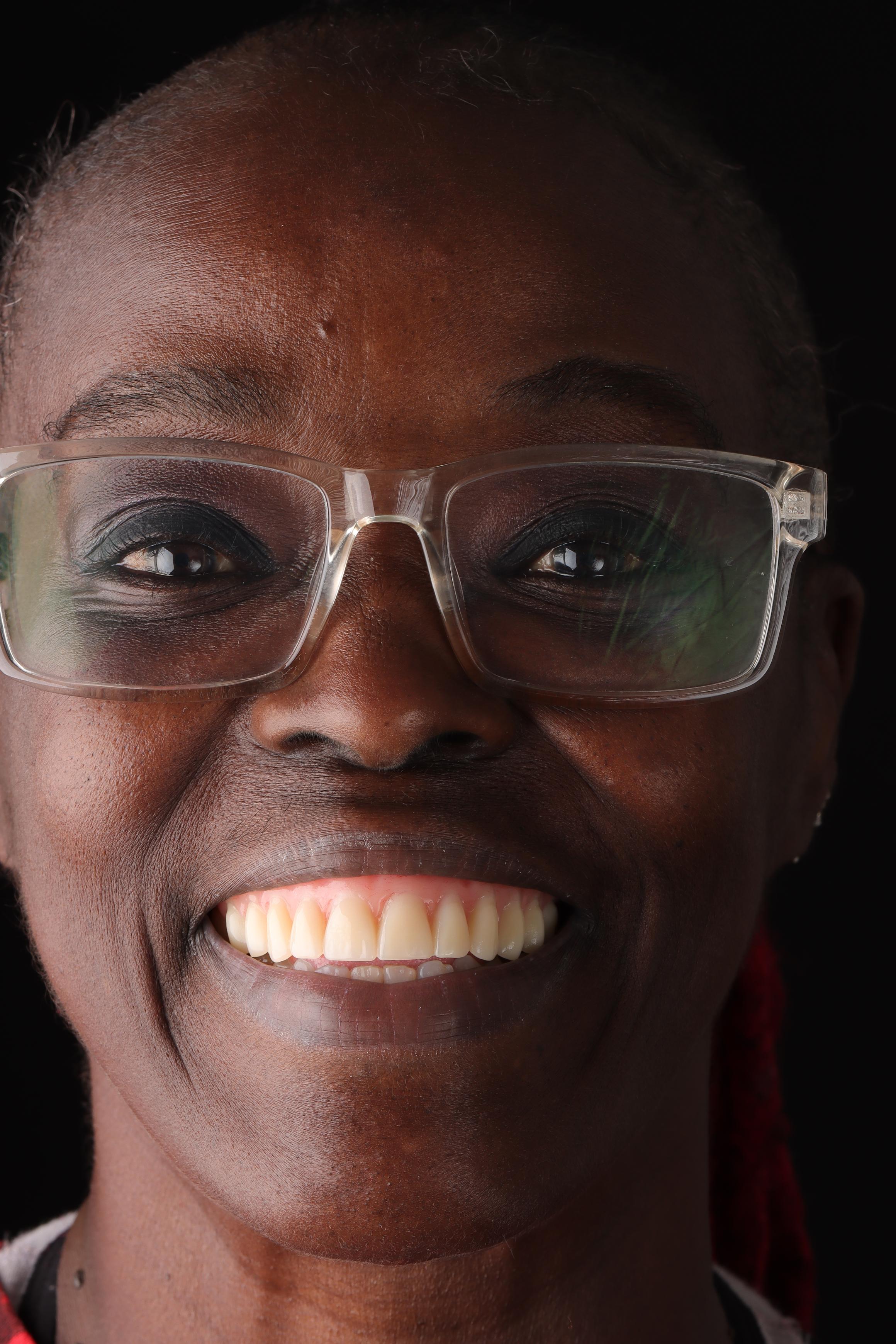 Tonya after treatment