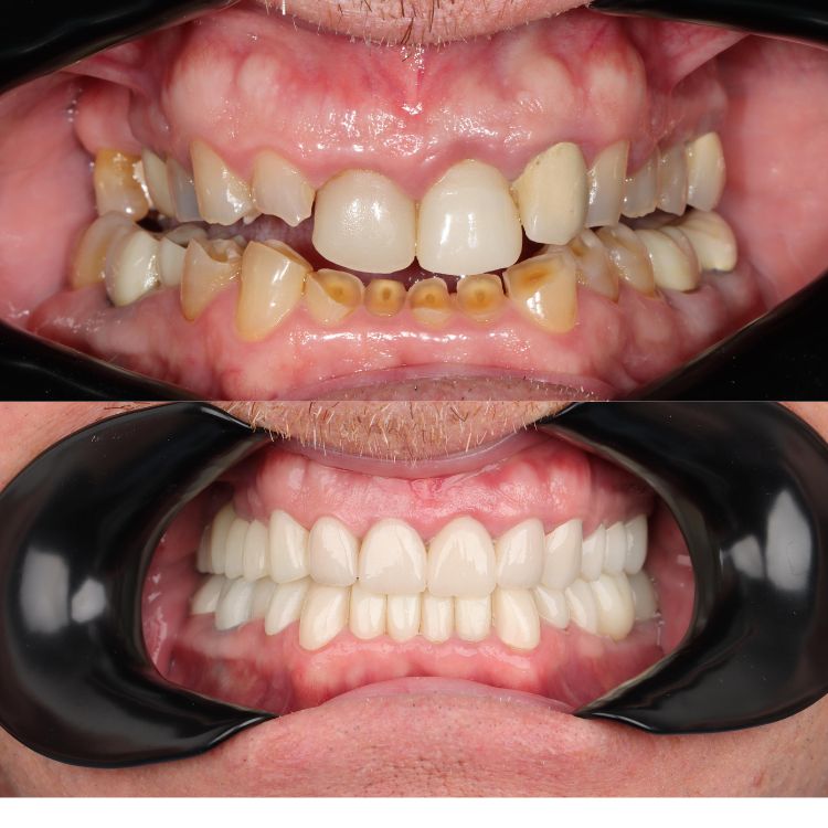 Intercoastal Dental before and after